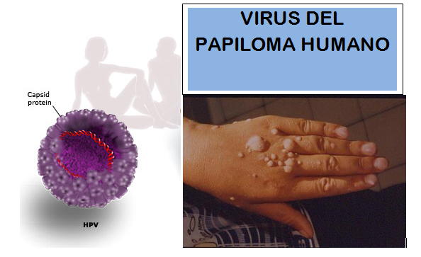 virus del papiloma a