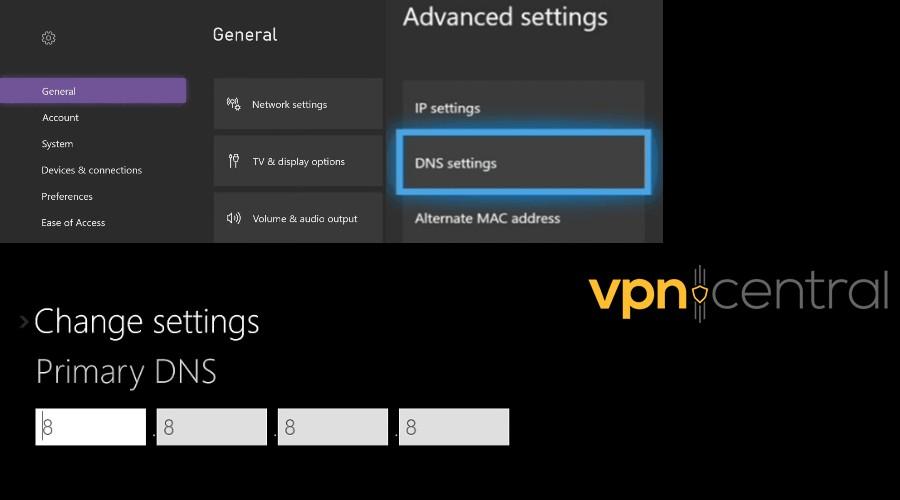 xbox dns settings change primary dns