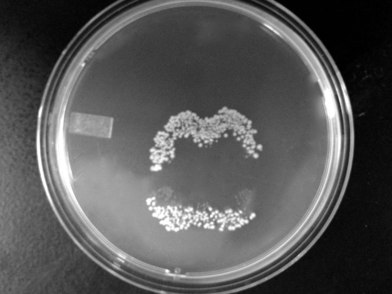 This image has an empty alt attribute; its file name is Lip_print_in_bacteria_on_agar_plate-790x593.jpg