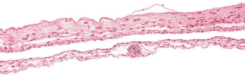 Allantoic and amnionic membranes with allantoic blood vessel in the center at the bottom.