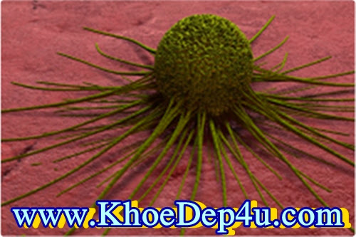 NẤM LINH CHI CÓ TÁC DỤNG GÌ VỚI BỆNH UNG THƯ?