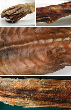 สิ่งที่ Ötzi มนุษย์น้ำแข็งยุคก่อนประวัติศาสตร์สามารถสอนเราเกี่ยวกับการใช้รอยสักในการรักษาตามพิธีการได้ 1