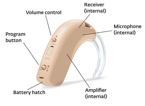 The difference between Analog and Digital Hearing Aids