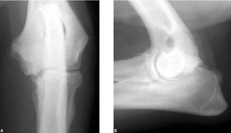 Cranial-caudal radiograph showing subchondral lucency and osteophyte formation on the medial elbow joint