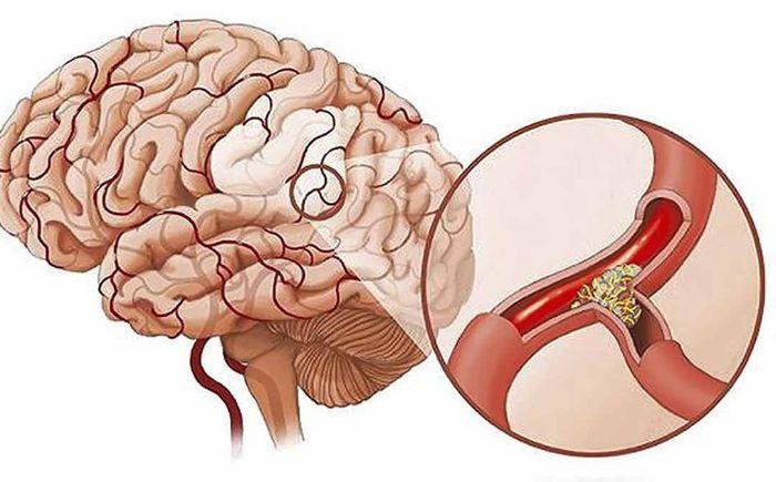 Tăng cường dưỡng chất, oxy lên vùng não và giúp tăng cường trí nhớ.