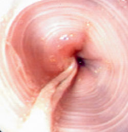 Twine visible in the esophagus of a one-year-old male Exotic Shorthair