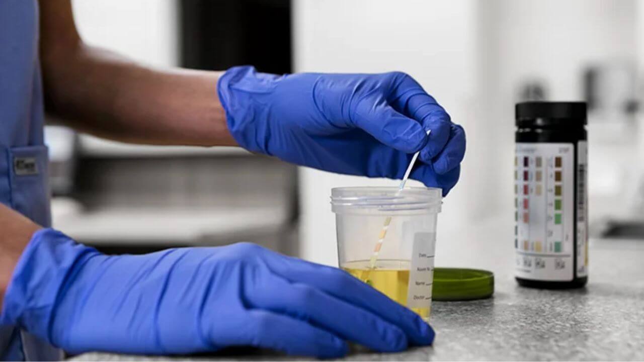 How To Take Urine Tests For Drugs?