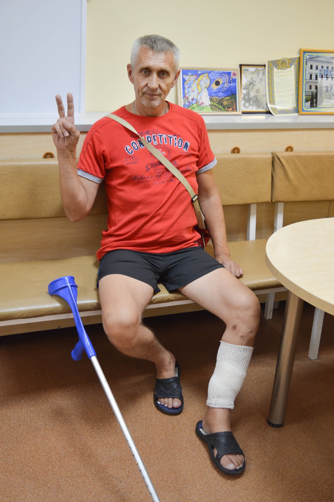 Serhiy, 53 years old, from the Donetsk Oblast, was wounded near Ilovaisk in August 2014. He has been receiving treatment in the Mechnikov Hospital since then. He is missing 10 centimeters of the bone in his leg. ~