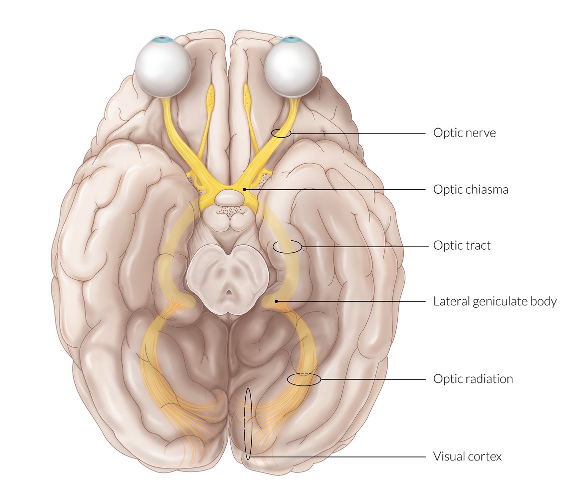 Disorders of the visual pathway - AMBOSS