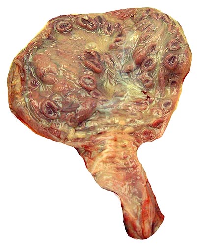 Fetus removed with four rows of cotyledons visible