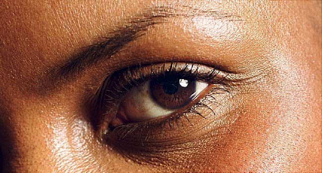 สีของดวงตาและรูปร่างบอกอะไรเกี่ยวกับสุขภาพของคุณได้บ้าง ! 16