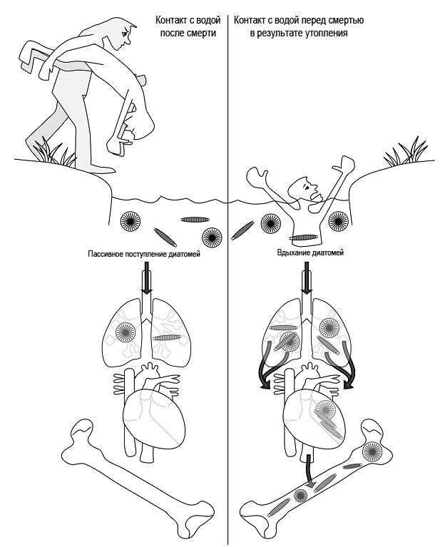 Рисунок 4 - Установление причины смерти в воде с помощью диатомовых водорослей 