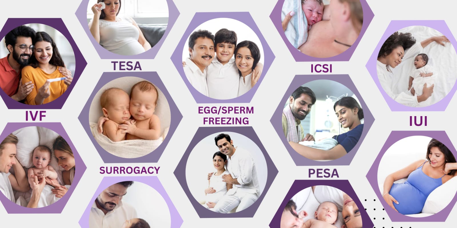 Affordable infertility treatments at the Fertilityworld