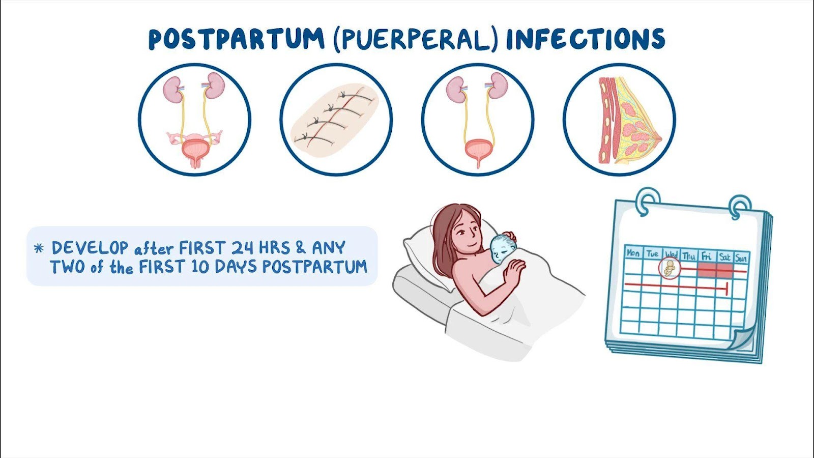 Postpartum infections: Nursing - Osmosis Video Library