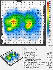 https://www.vicair.com/wp-content/uploads/2018/12/Pressure-Map-Vector-O2-NL-T.R.-227x300.jpg