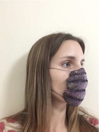 Part of three photographs of a white woman with long dark blonde hair, wearing clothes with large pink dots and her own Personal Protective Purple Daikon Equipment. The text above mentioned proudness, but she mainly looks tired. Her Personal Protective Purple Daikon Equipment covers her face from her nose to her chin. This photo is a three-quarter view while she is facing right.