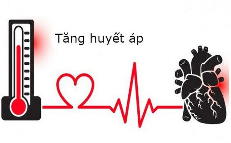 nguyên nhân tăng huyết áp