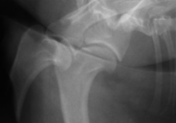 Lateral thoracic radiograph showing severe tracheal collapse at the thoracic inlet