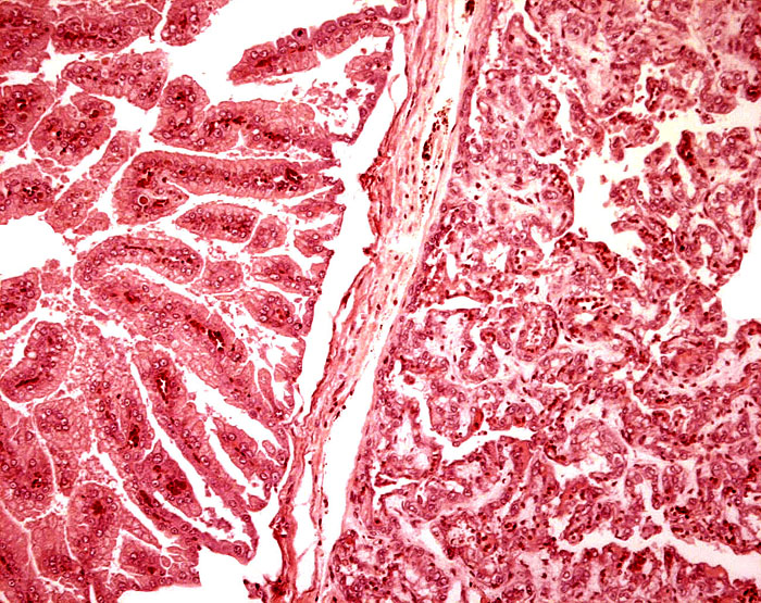 Higher magnification of ‘areolar’ region (left) and adjacent villous tissue (right).