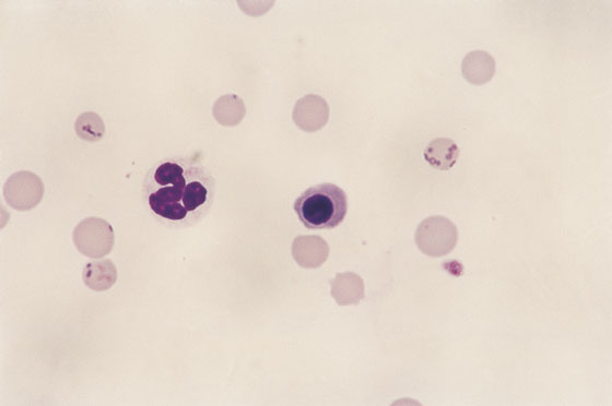 Feline blood. In a thin area of the smear, the ring forms of the parasite are visible in small chains or groups on the RBC membrane (100x).