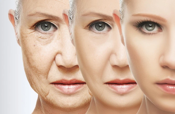 Signs of Aging Treatment - Dermatologist in Jaipur 