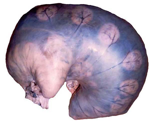 Serow fetus in uterus at 212 days gestation