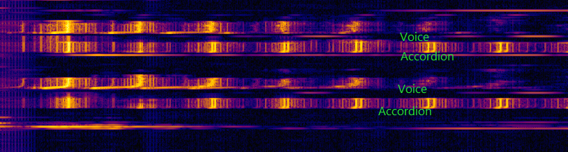 Photo comparing voice and accordion notes