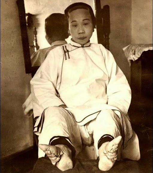 Mulher com pés de Lótus Mulher com pés de Lótus