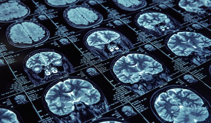 Top 5 Use Cases for Artificial Intelligence in Medical Imaging