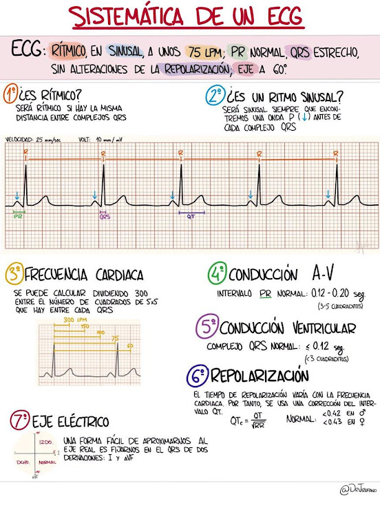 DrJirofano on Twitter: &quot;Es importante tener una sistemática constante a la  hora de leer un electrocardiograma. Muchas son válidas, esta es una de  ellas para no dejarse nada. El próximo de electros