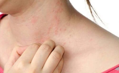 rashes on sensitive skin