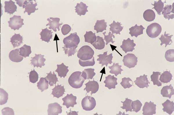 Canine blood. The poikilocytes in this blood smear have irregular membrane...