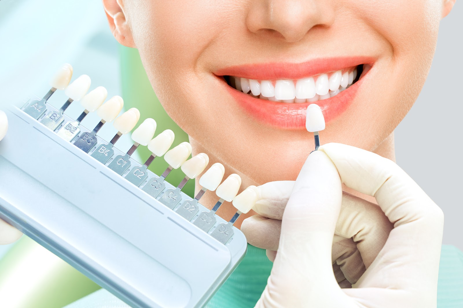 Fatete dentare - Clinica SyroDent