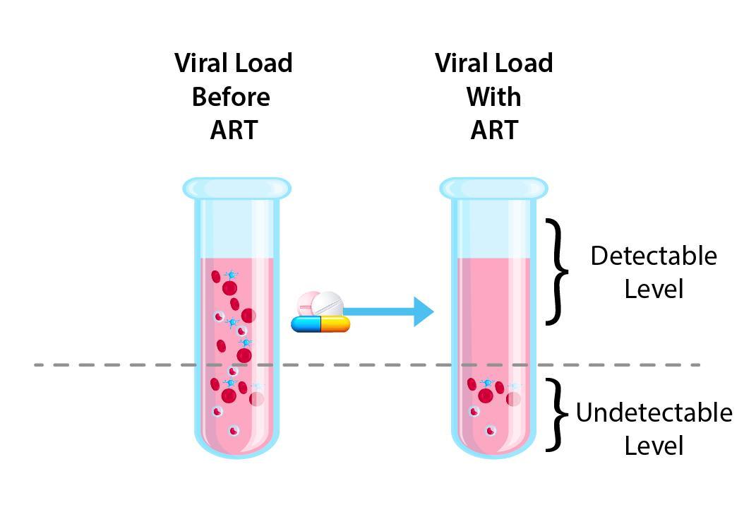 Viral load before and after ART 