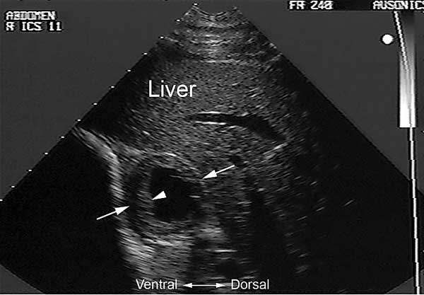 Location of descending duodenum (arrows) deep to right liver lobe in right mid intercostal spaces