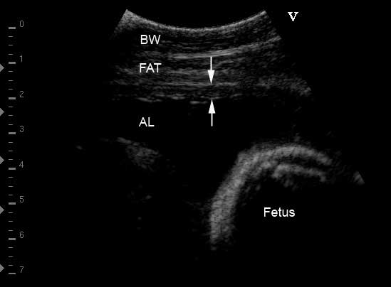 Allantoic fluid located deep and adjacent to uteroplacental unit
