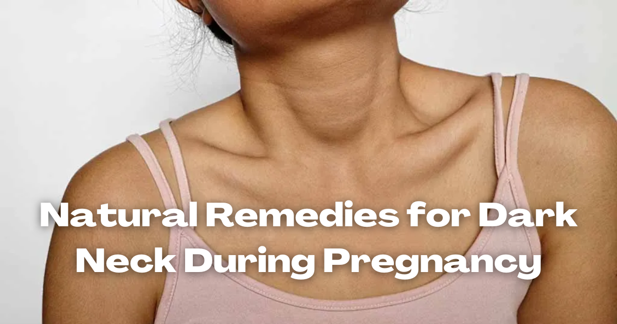 Natural Remedies for Dark Neck During Pregnancy