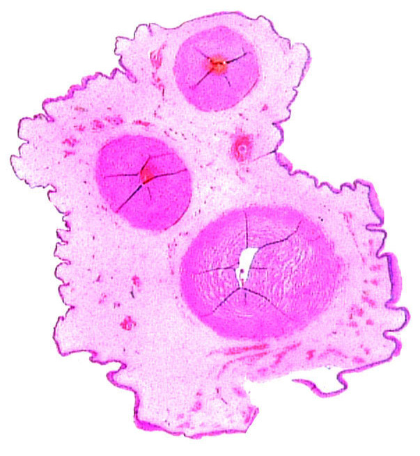 Cross section of one umbilical cord with its small allantoic duct at top right.