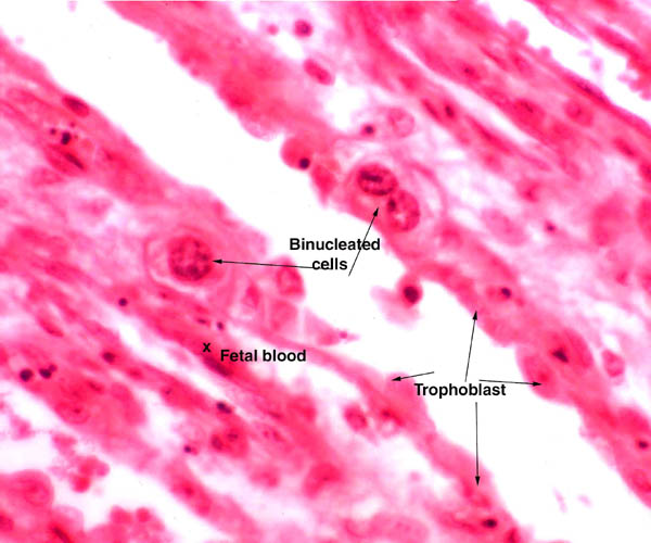 Higher magnification of trophoblastic surface of the villi