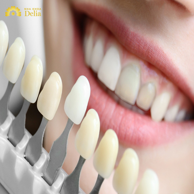 Răng bị xỉn màu ố vàng thường xuyên xảy ra 