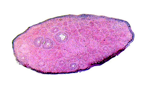 Neonatal ovary with early follicular development and masses of "interstitial gland".