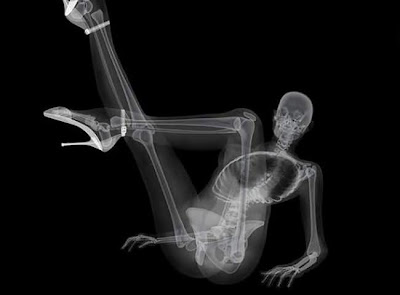 foto x-ray seksi