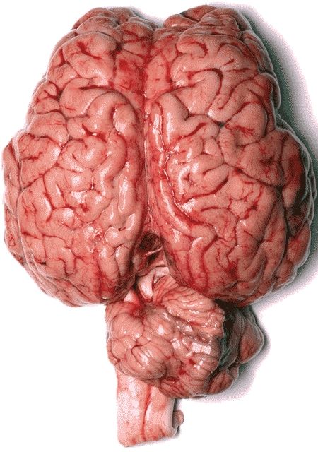 brainDT 146097 Inilah otak manusia