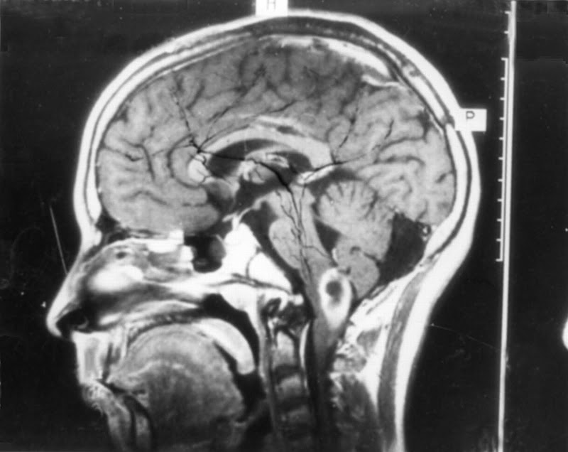 MRI%20copy.jpg