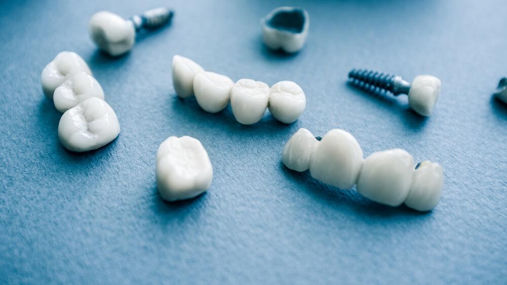dental implant centers in Toronto