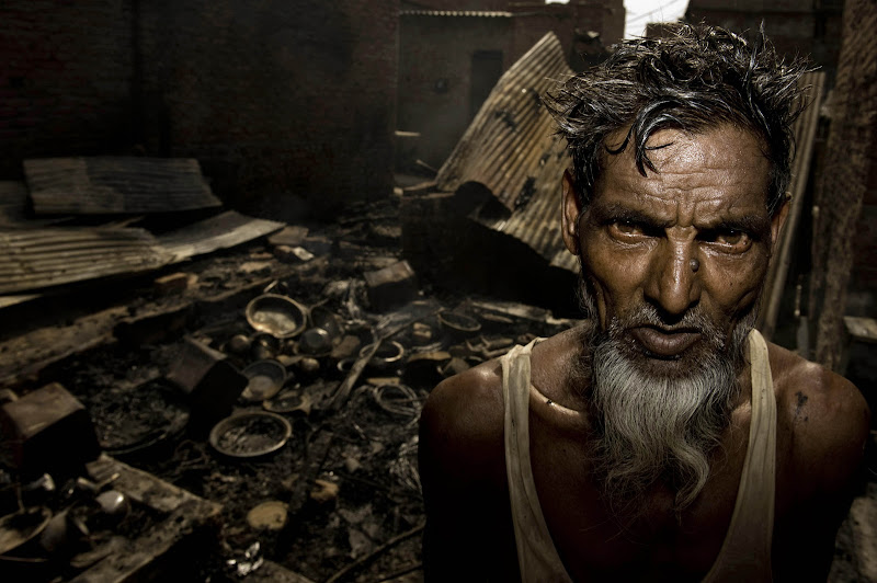 Imtiaaz A Fire in a Slum