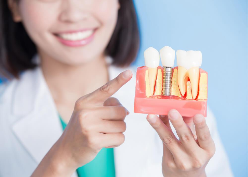 dental implants center in Thornhill 