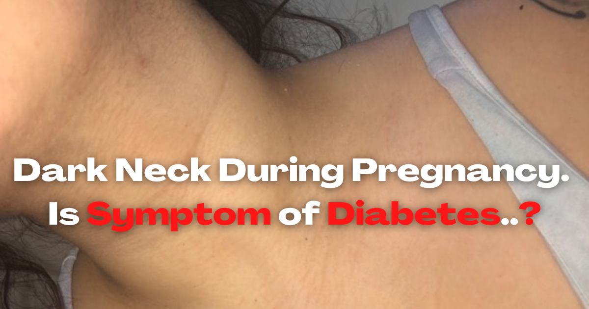 Dark Neck During Pregnancy Diabetes