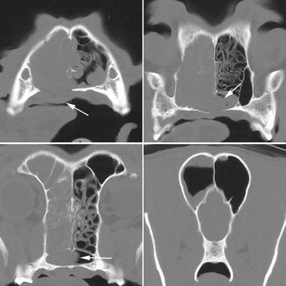 CT scans of a 10-year-old, neutered male, mixed-breed dog depicting a destructive sinorhinopathy with mass effect. 