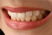 teeth or tooth